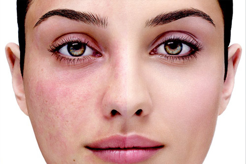 kamuflaş makyaj nasıl yapılır